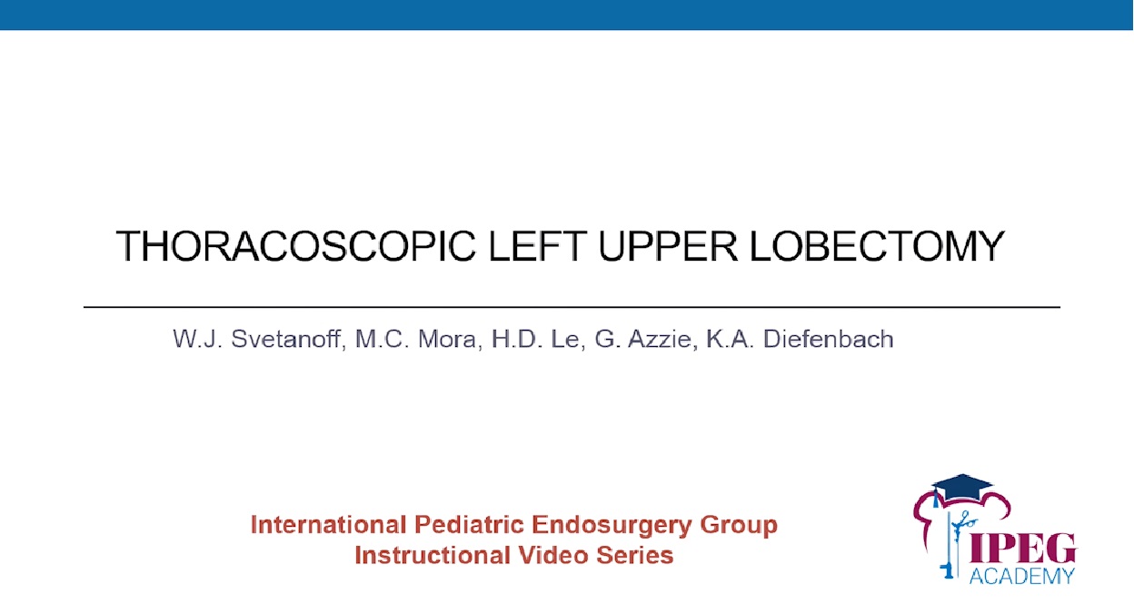 IPEG Academy: Thoracoscopic Left Upper Lobectomy