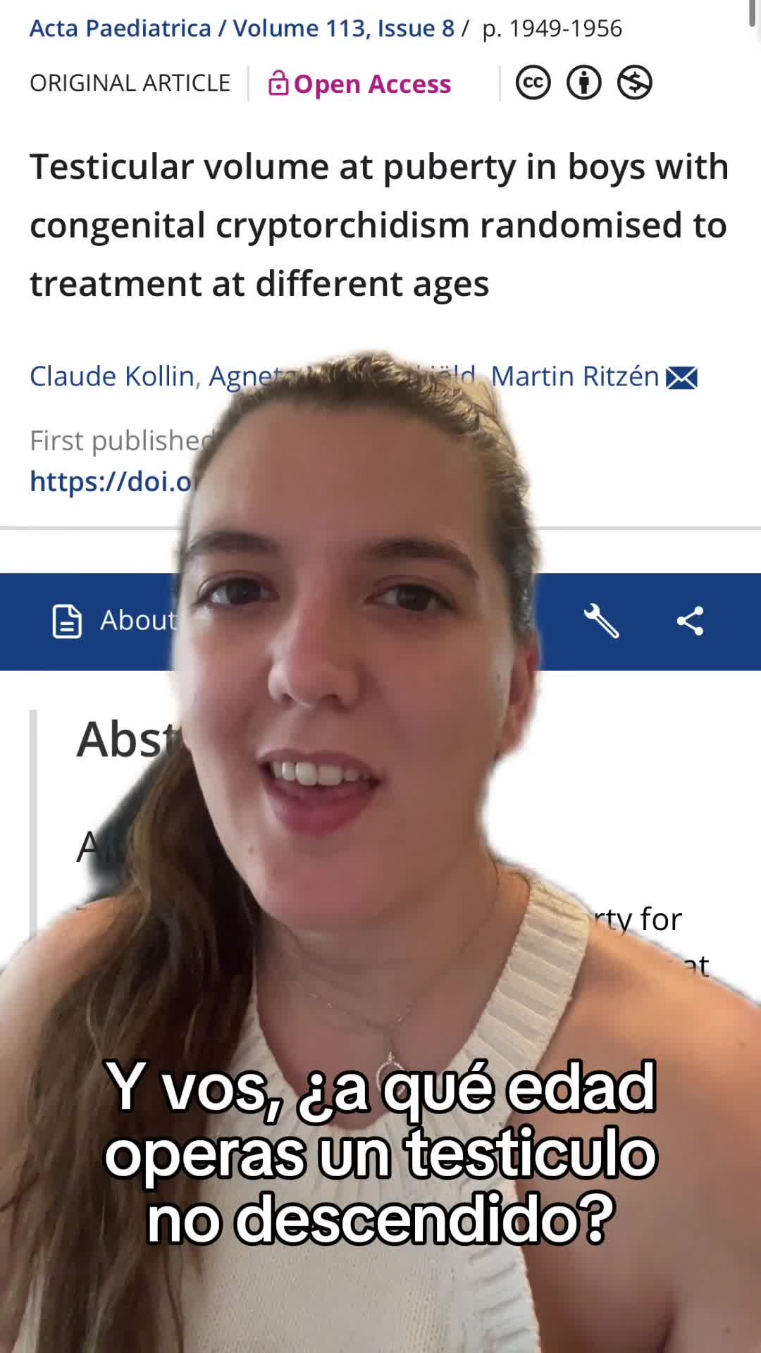 Volumen testicular en la pubertad en niños con criptorquidia congénita aleatorizados a tratamiento en diferentes edades