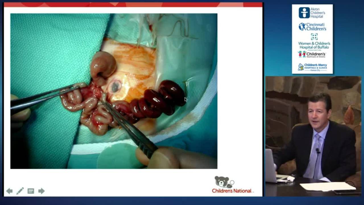 Ileal Atresia Rapid Fire: Update Course 2015